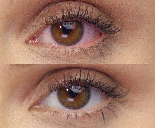 Before and after shot of an eye after using Lumify eye drops